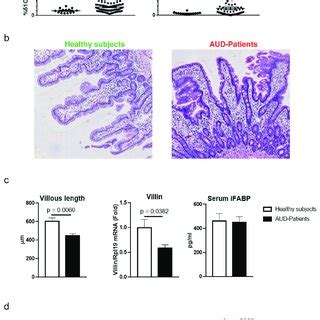 the intestinal permeability ip assessment is a noninvasive test cost|leaky intestine test results.